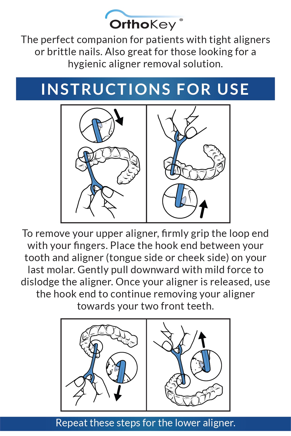 OrthoKey Clear Aligner Removal Tool